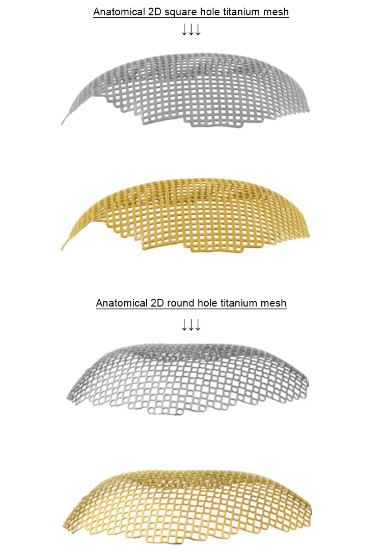 Orthopedic Surgical Neurosurgery Titanium Mesh Cmf Maxillofacial Implants