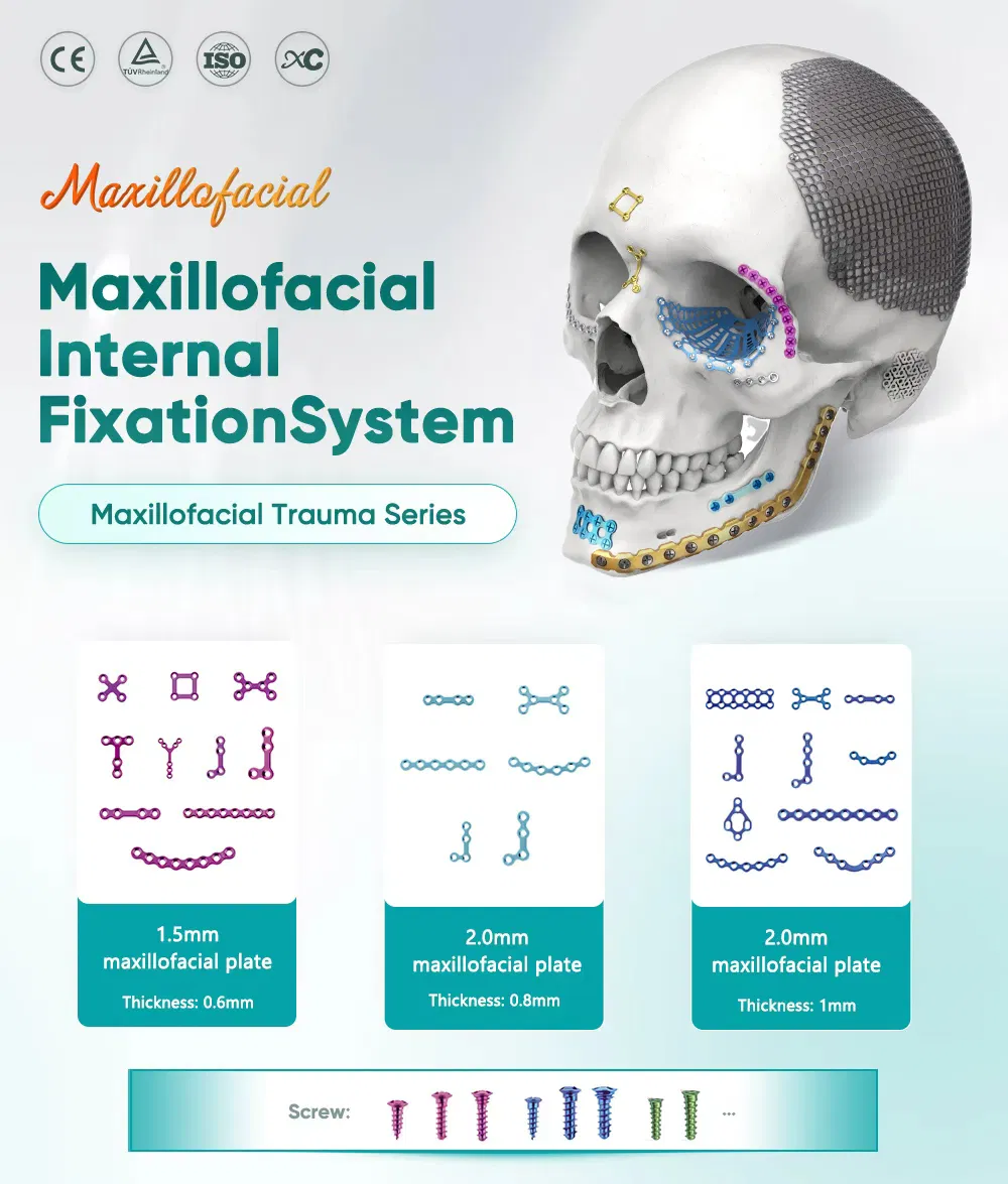 Maxillofacial Plate Implant