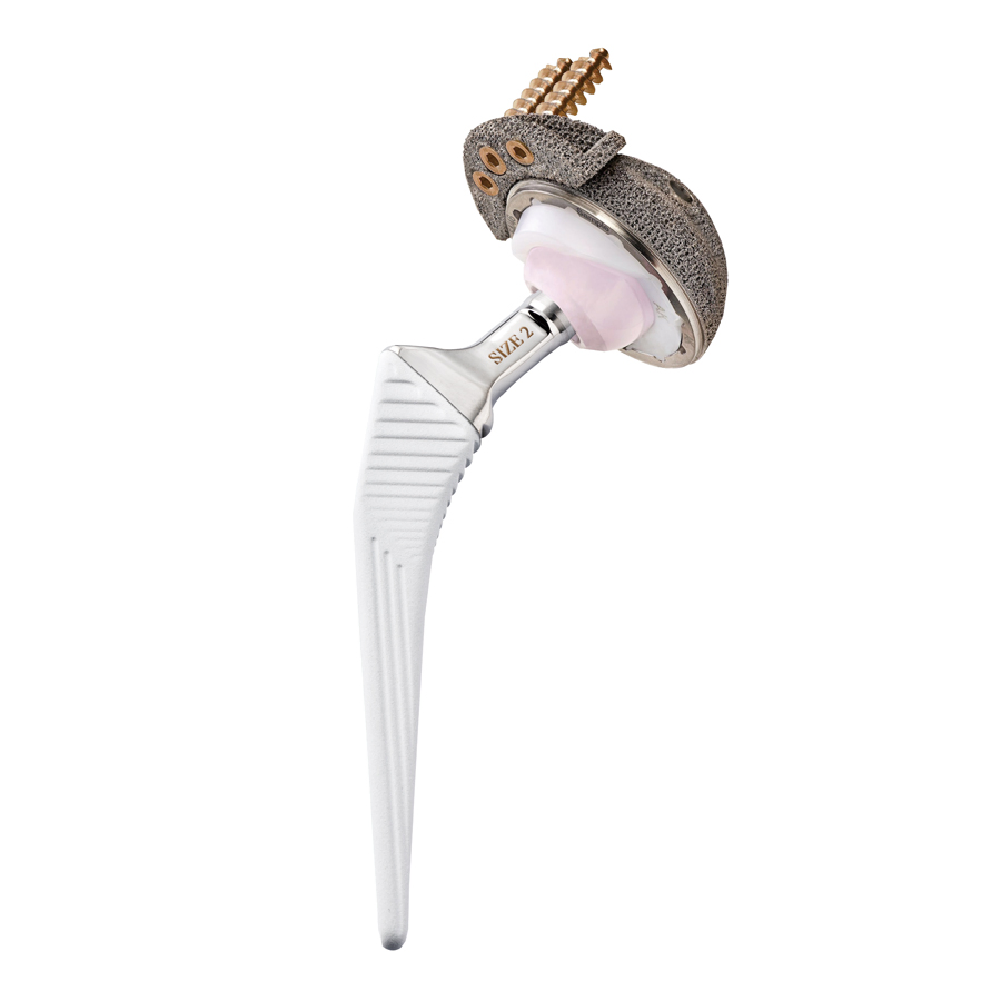 Orthopaedic Ti-Alloy Cementless Thr Total Hip Joint Replacement