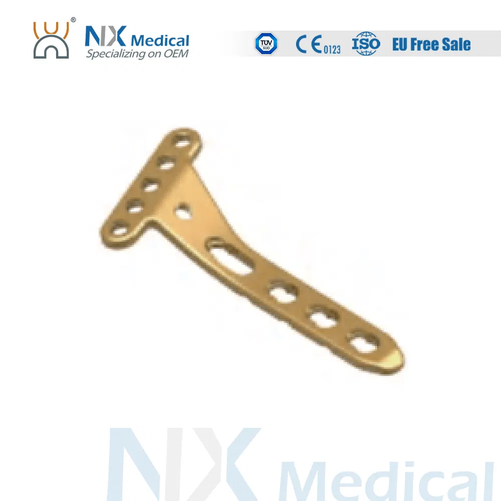 Nx Medical Variable Angle LCP Plate Radius Fragment Locking Mechanism System