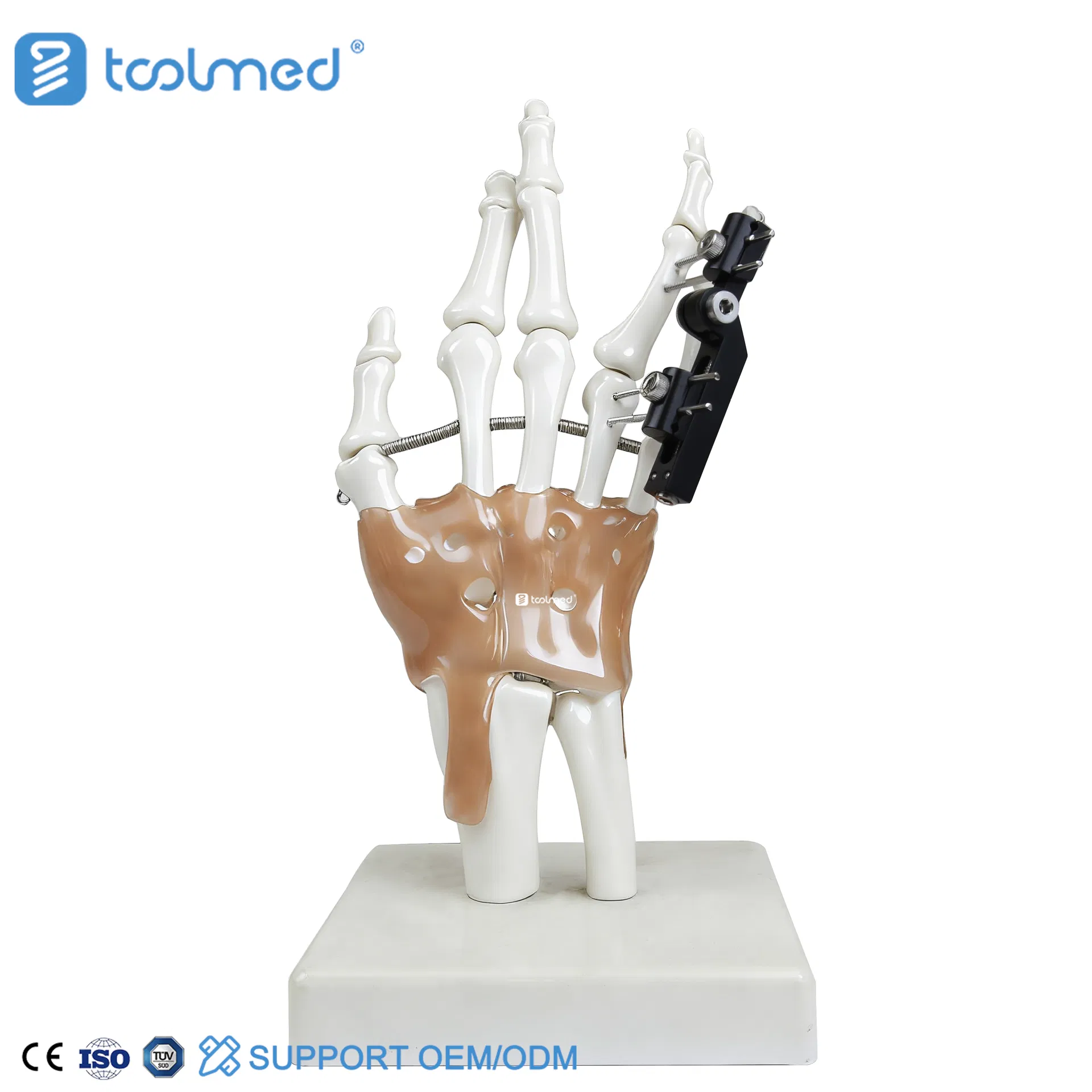 Finger Fracture Orthopedic Surgical