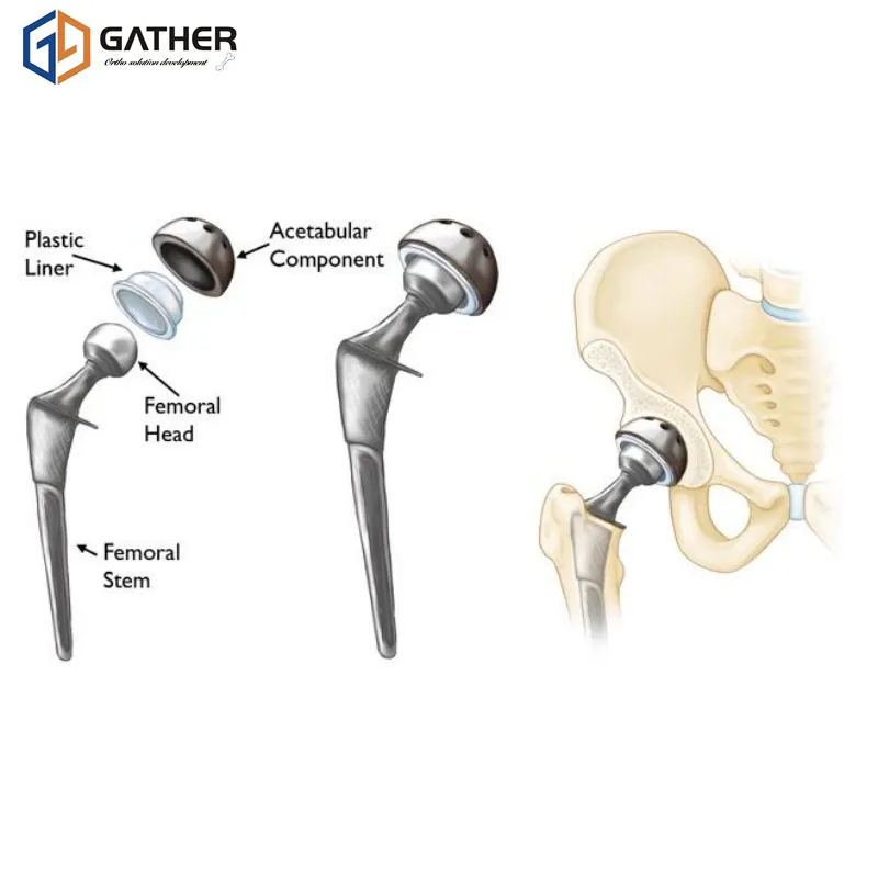Knee Joint Component