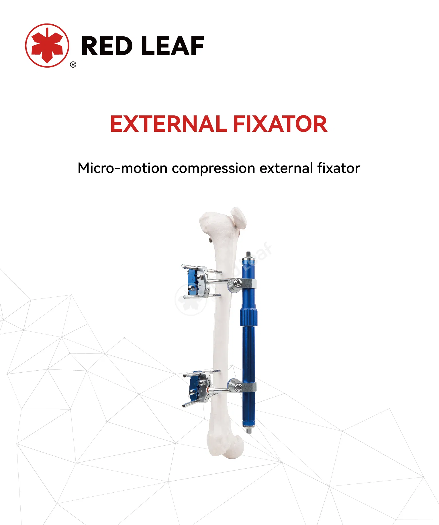 Orthopedic External Fixation System