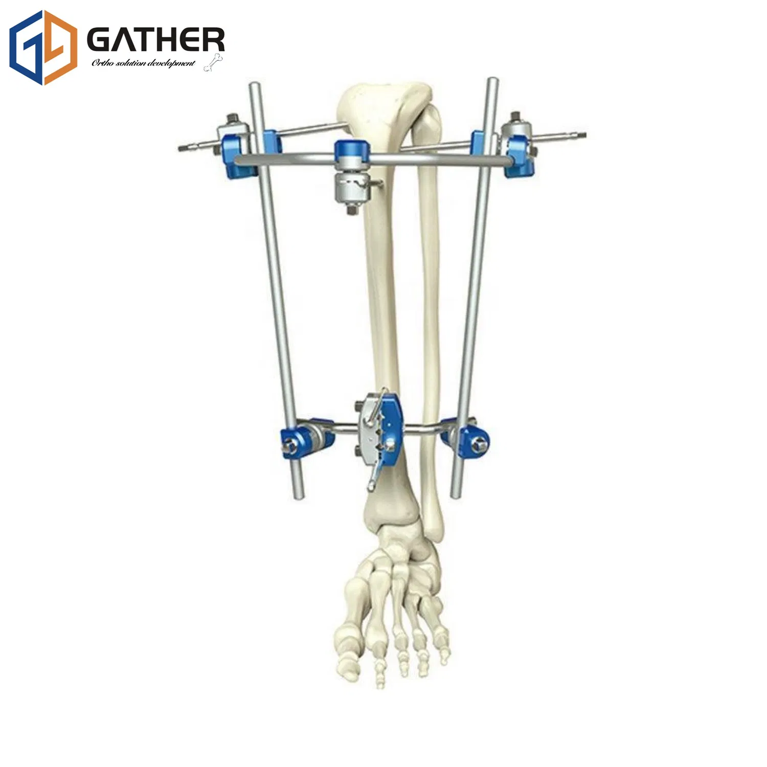 Factory Price New CE Approved Finger Splint Bone Fracture Distal Radius External Fixator