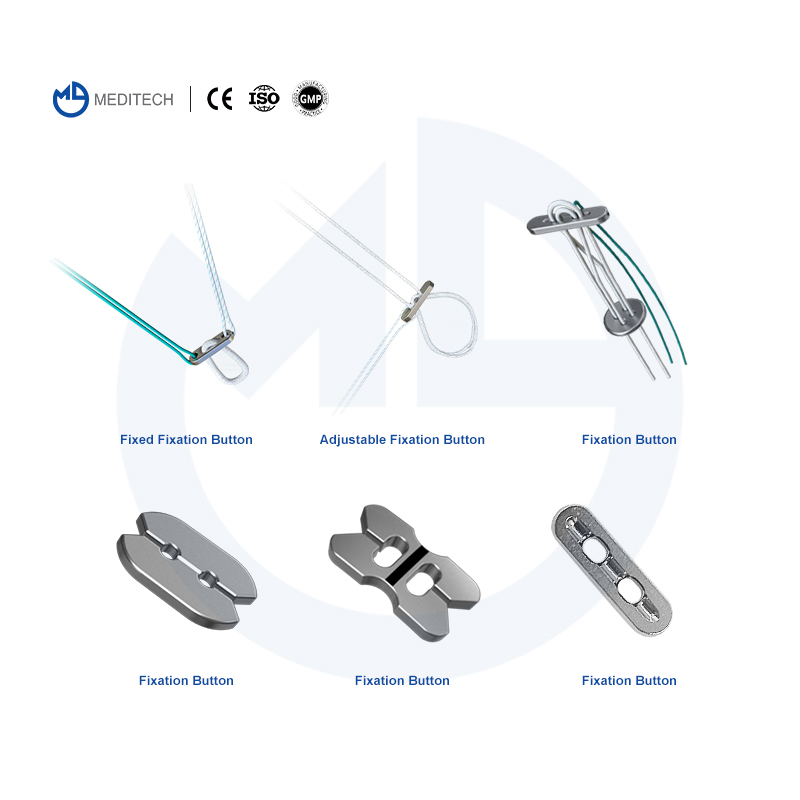 Sports Medicine All-Suture Anchor Absorbable Knotless Suture Anchor Surgical Sutures Knee Arthroscopy All Inside Meniscus Repair