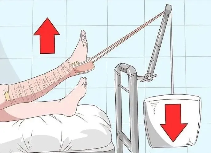 Skin Traction Detail 4