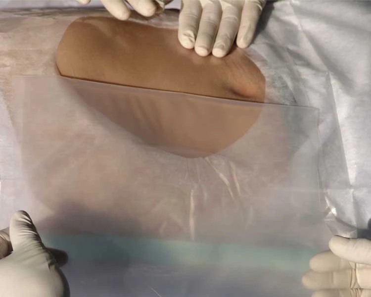 Sterile Transparent Surgical Incision Protective Operation Film Incise Drape