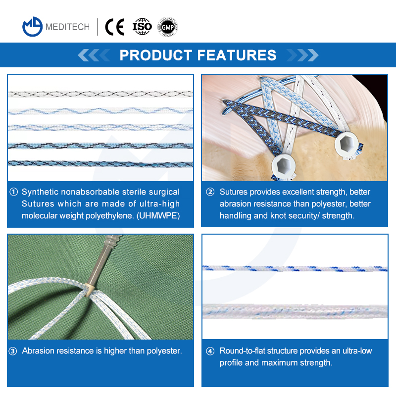 Sports Medicine All-Suture Anchor Absorbable Knotless Suture Anchor Surgical Sutures Knee Arthroscopy All Inside Meniscus Repair