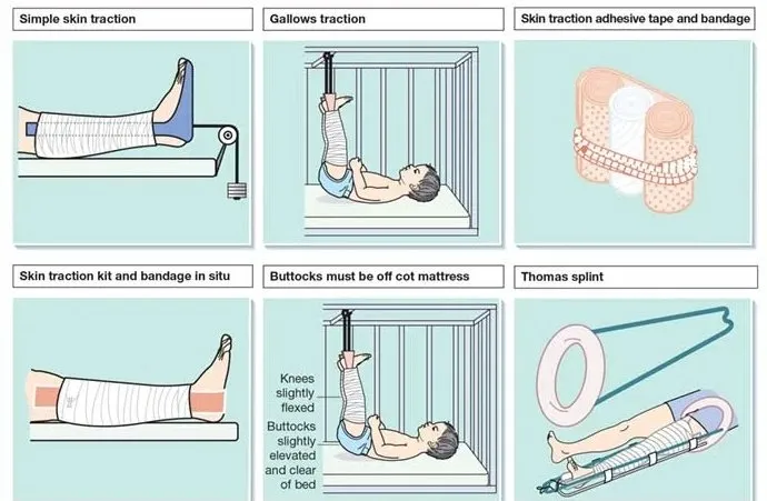 Skin Traction Detail 5