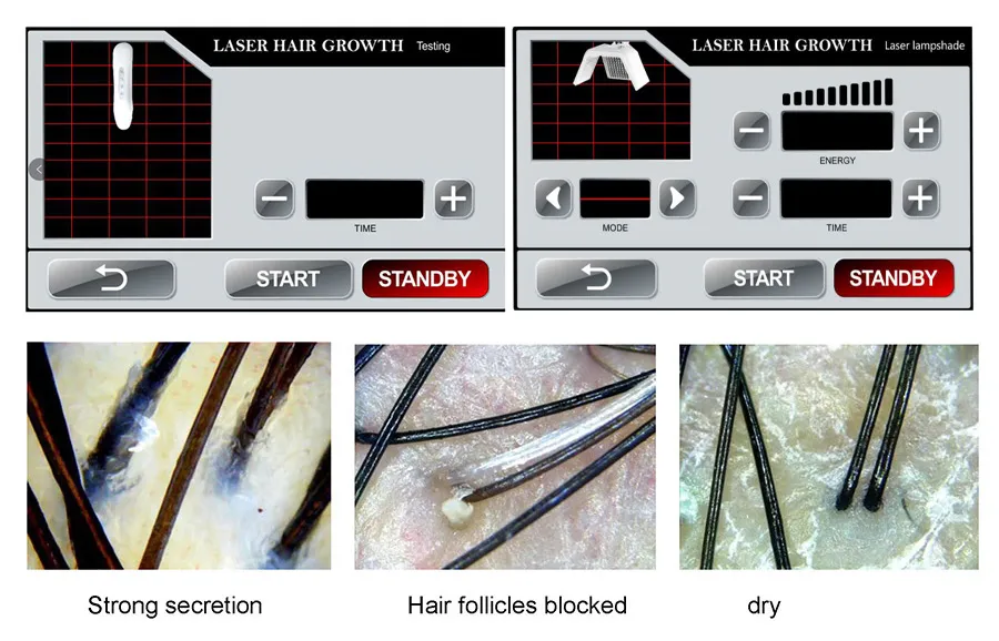 Dispositivo de Laser de Terapia Fotodinâmica Profissional Promove o Crescimento Capilar e Previne a Queda de Cabelo para Cabelos Mais Fortes e Saudáveis