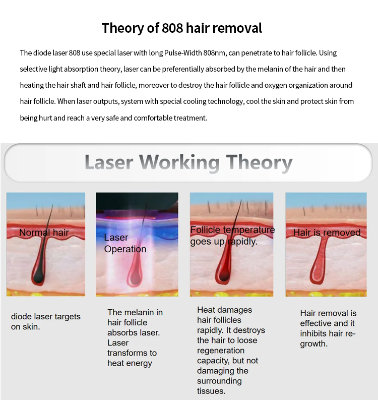Envio Grátis 808nm Máquina Profissional Mini Diodo Laser de Titânio para Remoção de Pelos Corporais 3 Dispositivo de Onda Permanente CE Mulher