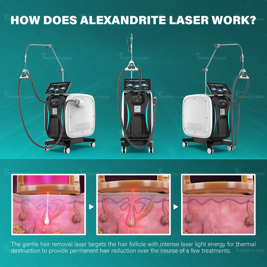 Princípio do Laser Alexandrite