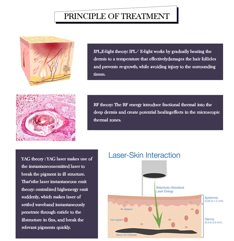 3 em 1 Dispositivo de Beleza IPL com Placa de Resfriamento no Japão para Remoção de Cabelo, Rejuvenescimento da Pele e Limpeza de Acne