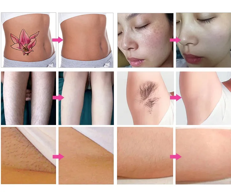 Resultados antes e depois