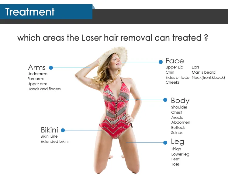 Equipamento de Salão de Beleza para Remoção de Pelo a Laser de Alexandrite Laser Diode