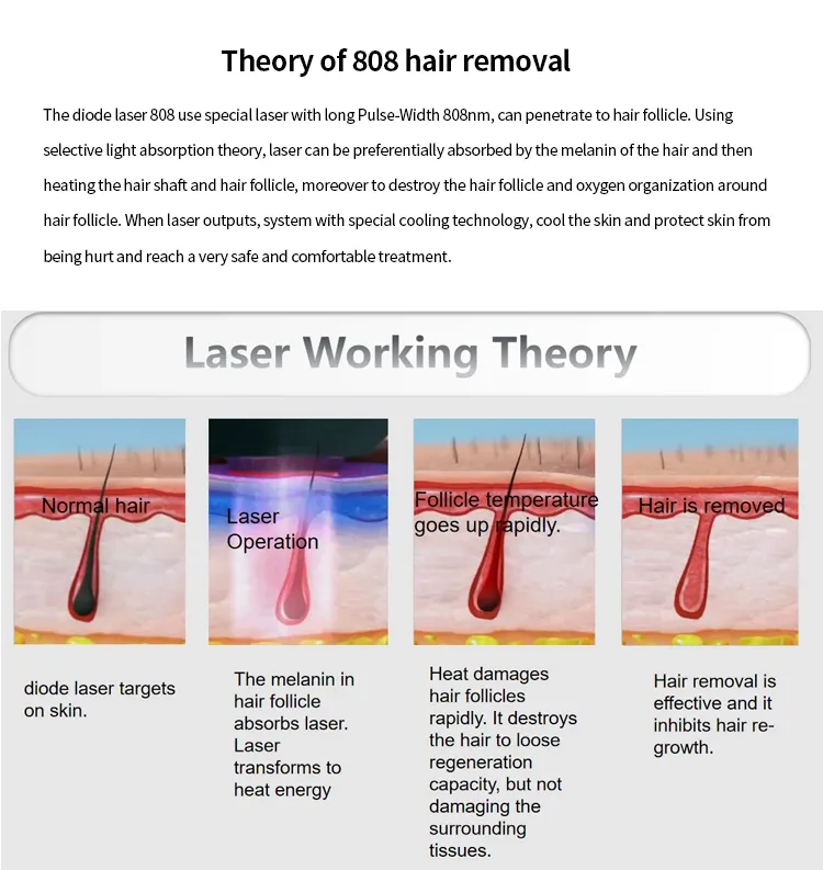 Máquina Profissional Mini Diodo Laser