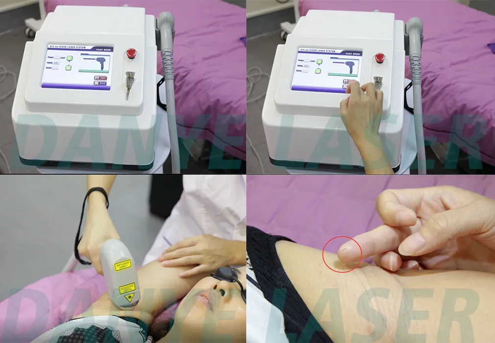 Dispositivo de Remoção de Cabelo a Laser Ice Platinum Diode Depiladora Portátil Permanente 808