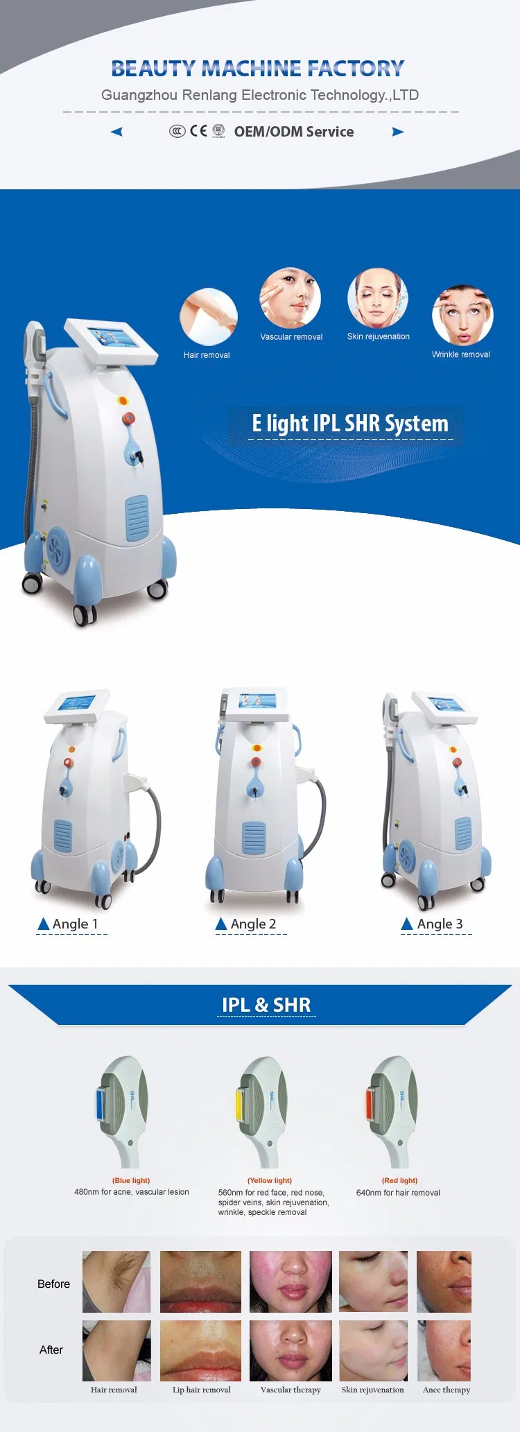 Nova Tecnologia Opt Sh, Epilador a Laser IPL para Remoção de Pelos