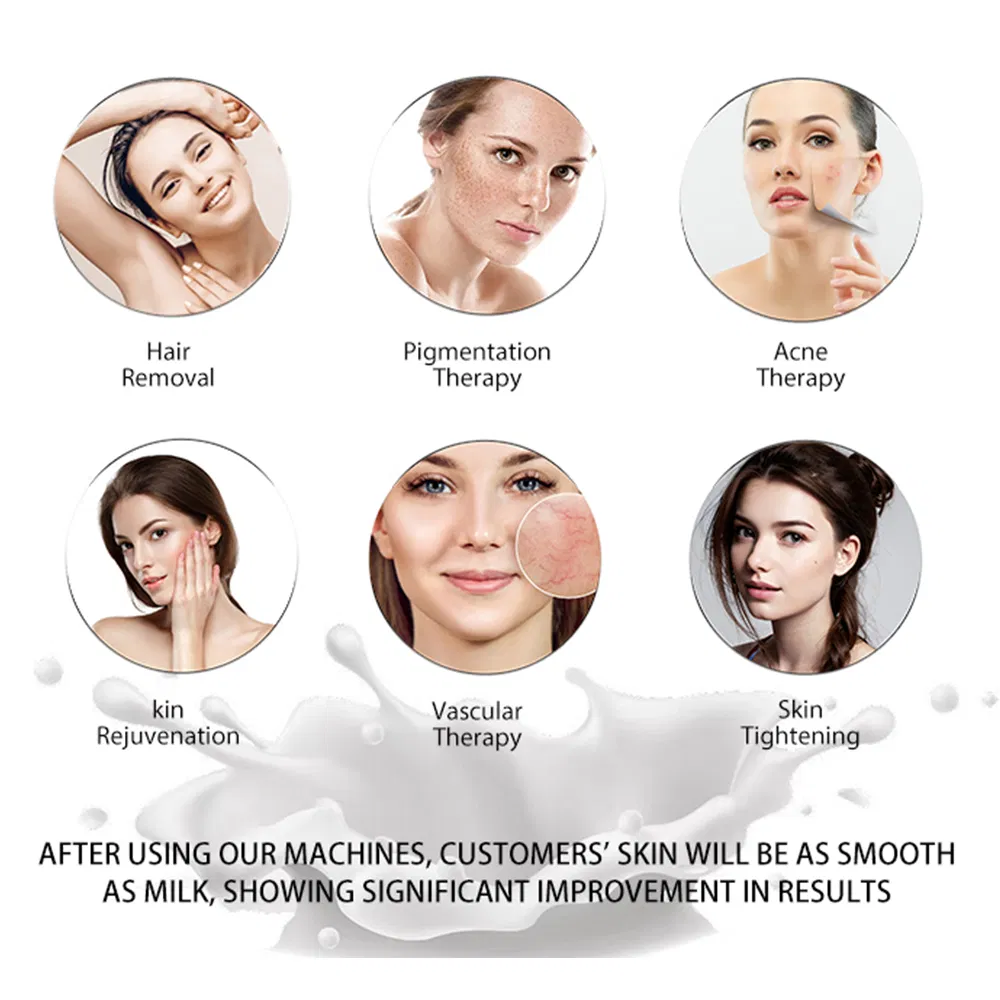 2000W Dpl Nir 2-in-1 Sistema com Filtros de Cristal de Gemas Dispositivo Profissional de Rejuvenescimento da Pele e Remoção de Pelos para Clínica