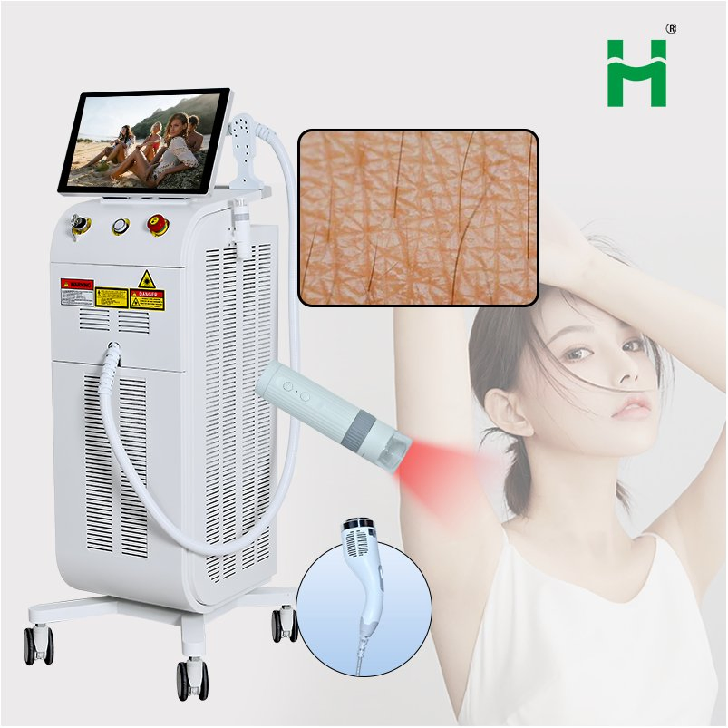 Máquina de Depilação a Laser Diode de Grau Profissional Popular Ótima para Clínicas Estéticas Preço com Desconto para Compras em Grande Escala