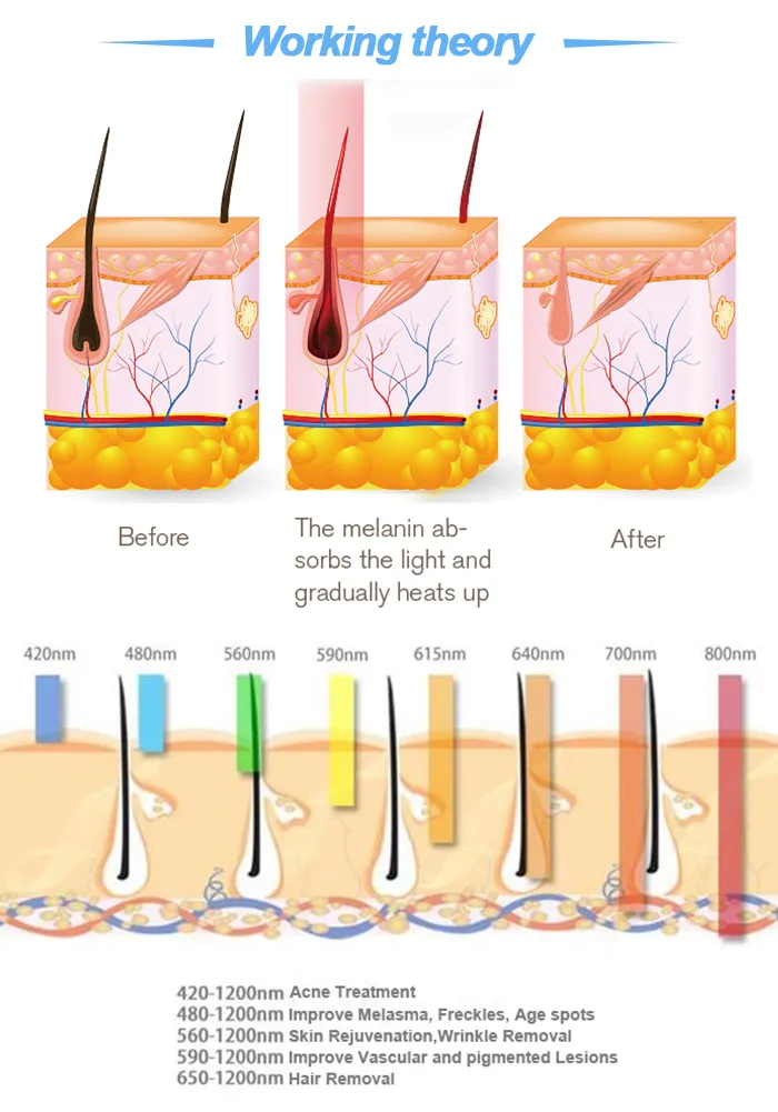 Equipamento de Beleza IPL com Duplas Alças para Remoção de Cabelo e Tratamento de Pele em Salão