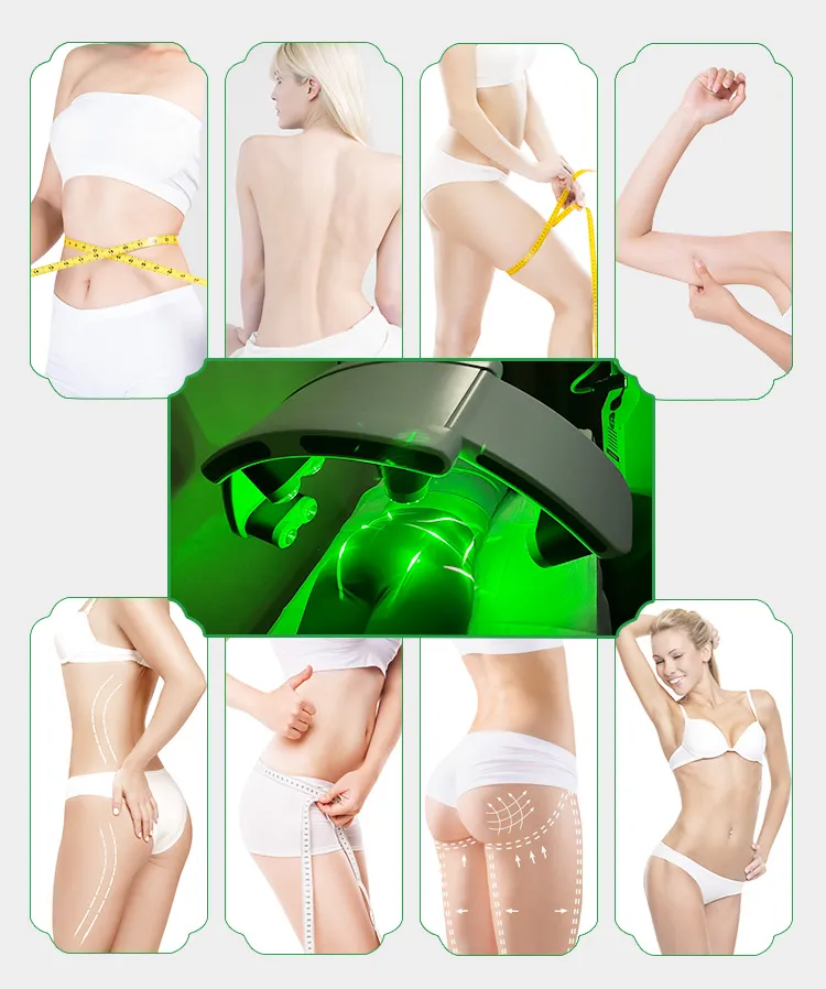 10d 532nm Dispositivo de Slimming a Laser para Redução de Celulite e Perda de Peso