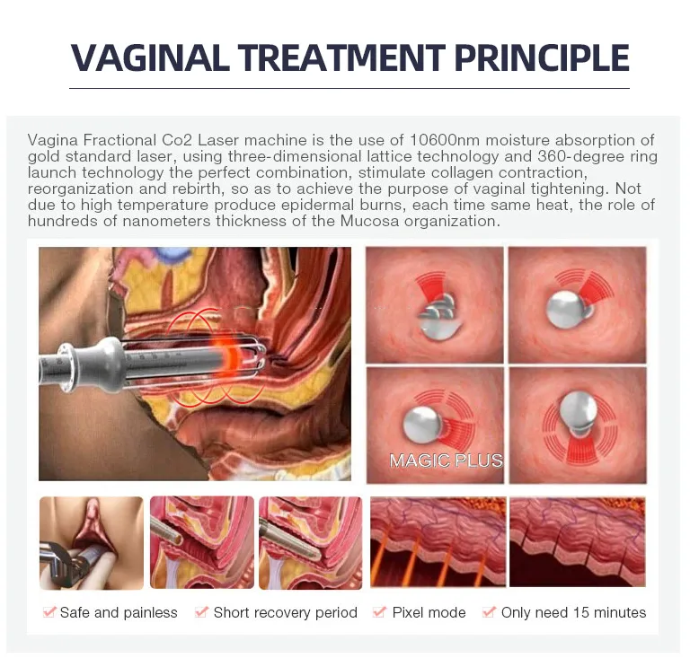 Sistema de Laser Fracionado Portátil CO2 Máquina de Aperto Vaginal Dispositivo de Remoção de Cicatrizes