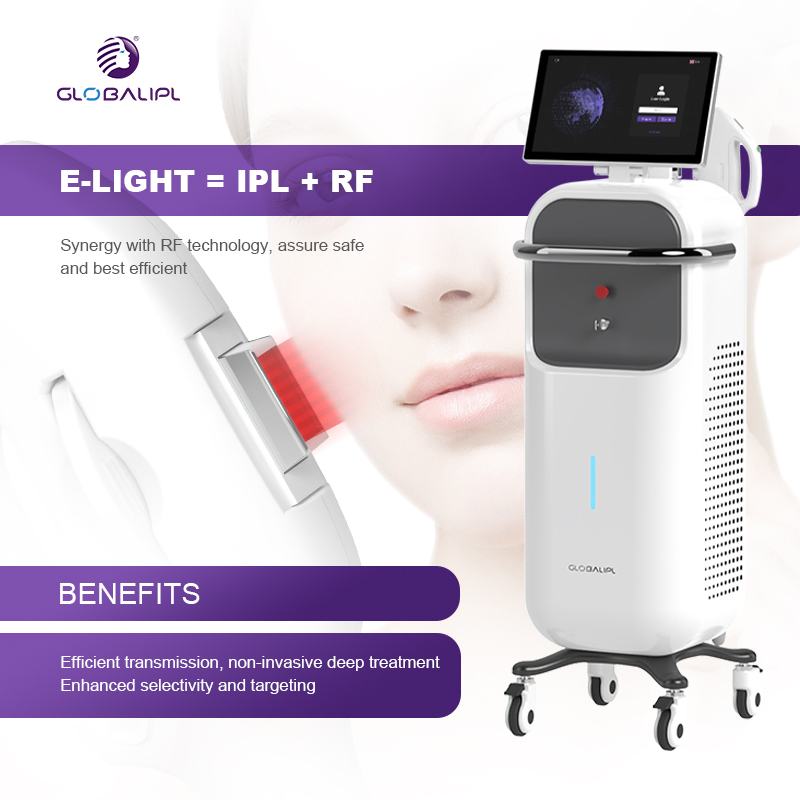 Dispositivo de Beleza para Remoção Permanente de Pelos, Correção de Pigmento, Clareamento Facial e Rejuvenescimento da Pele com Luz Pulsada Intensa