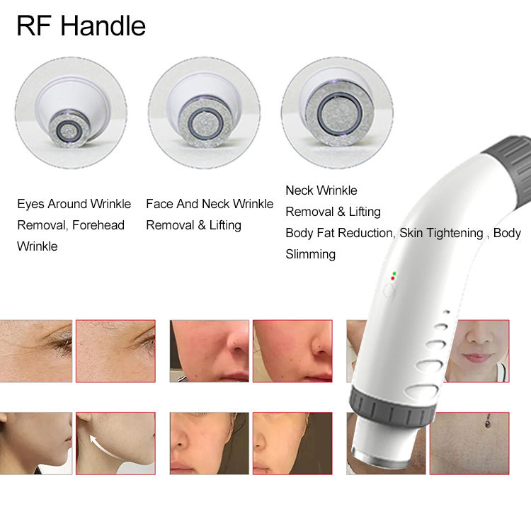 IPL Profissional Luz Intensa Pulsada 5 In1 IPL+Hr+Laser ND: YAG+ Laser de Diodo+ RF Dispositivo de Remoção de Pelos IPL