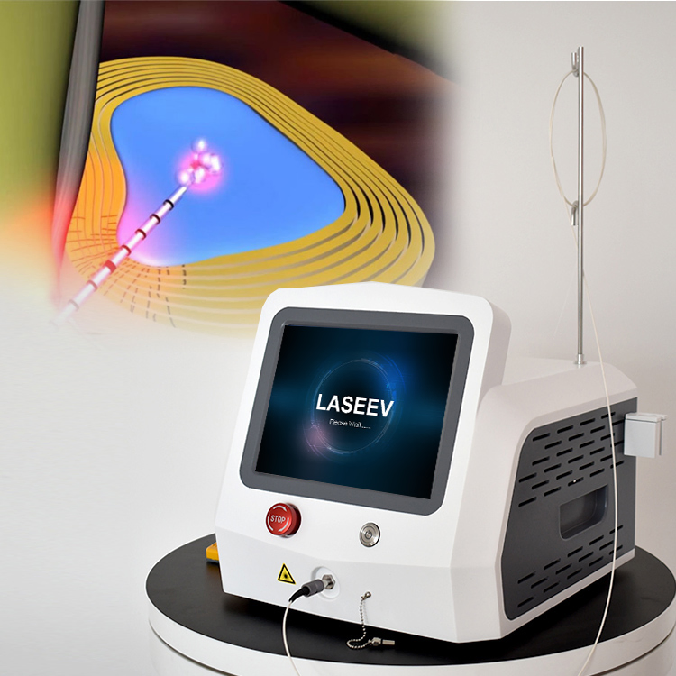 980 1470nm Máquina a Laser Pldd Fibra Nu Pldd Dispositivo de Dupla Onda