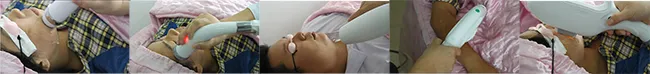 3 em 1 Dispositivo de Beleza IPL com Placa de Resfriamento no Japão para Remoção de Cabelo, Rejuvenescimento da Pele e Limpeza de Acne
