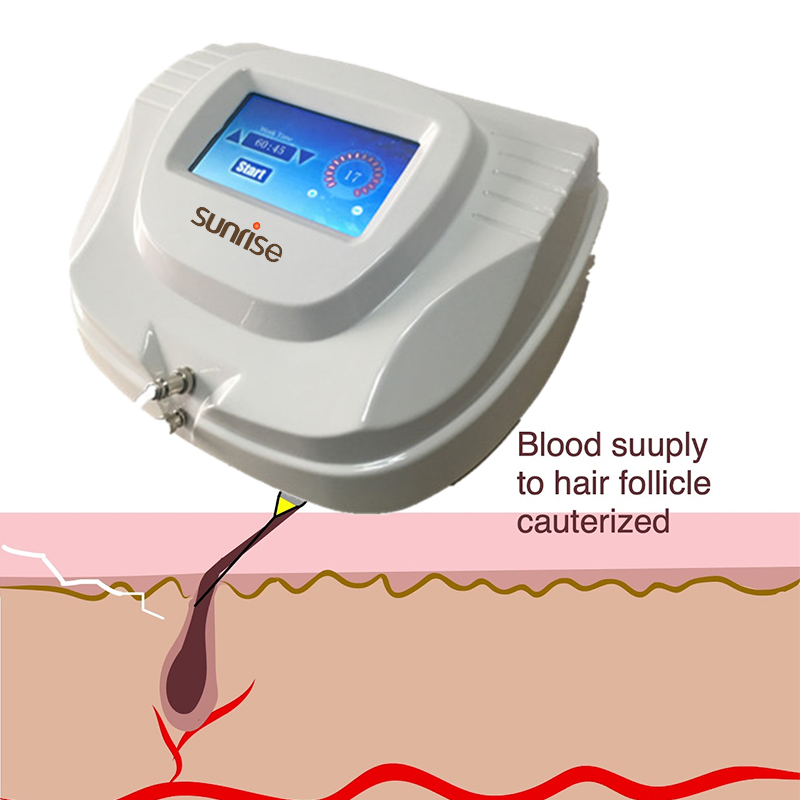 Máquina de Remoção de Pelos por Eletrolise de Alta Frequência Profissional Max Energy 17 com Agulha