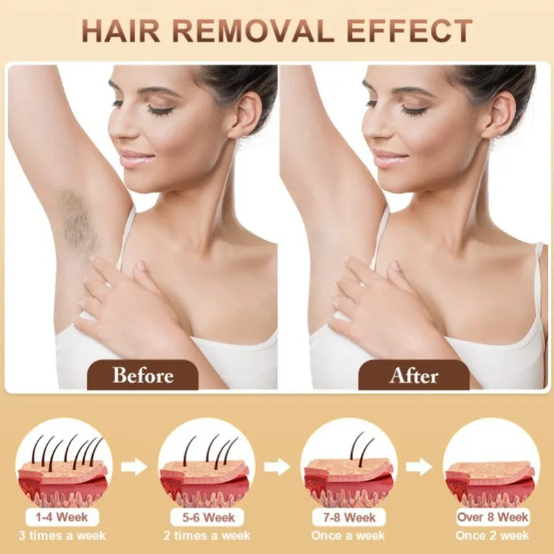 Dispositivo de Remoção de Cabelo a Laser Facial Painless para Uso Doméstico