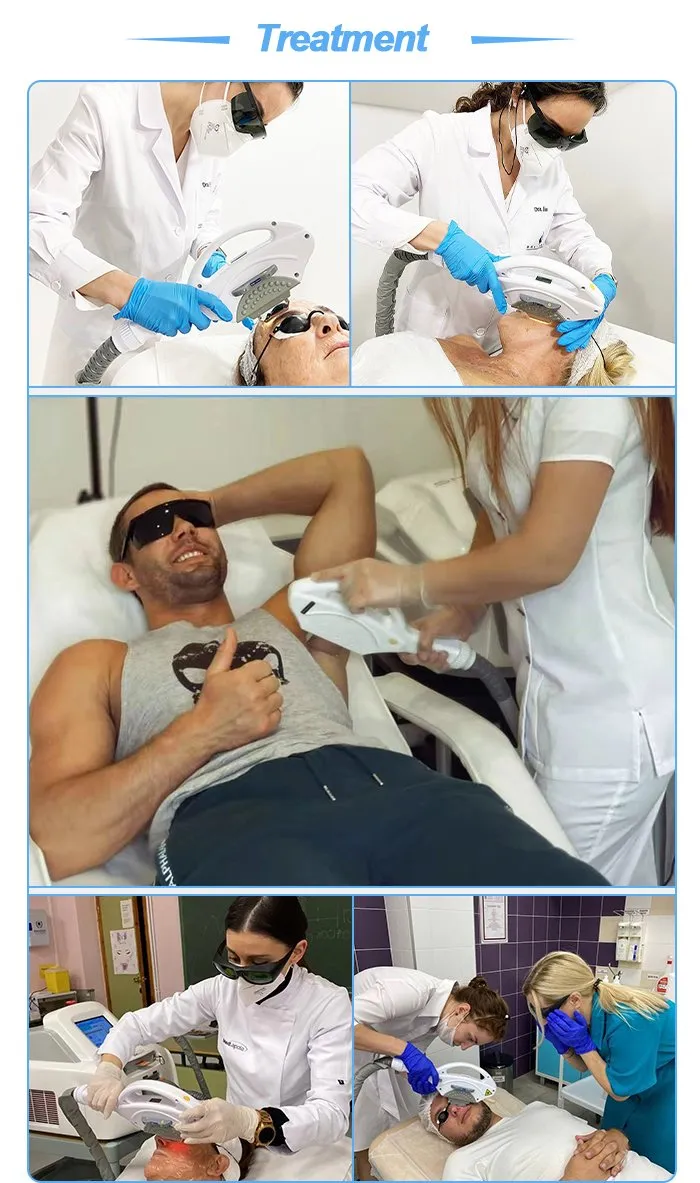 Equipamento de Beleza IPL com Duplas Alças para Remoção de Cabelo e Tratamento de Pele em Salão