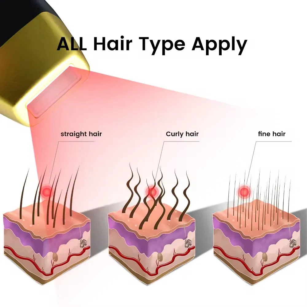Máquina de Remoção de Pelo a Laser Permanente de Titânio Sem Dor para Uso em SPA 755nm 808nm 1064nm Equipamento de Beleza para Salão a Laser Diode