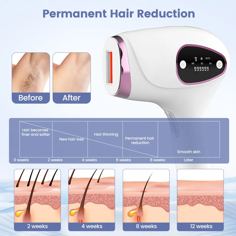 Dispositivo de Beleza para Remoção de Cabelo IPL Sem Dor e Portátil para Uso Doméstico