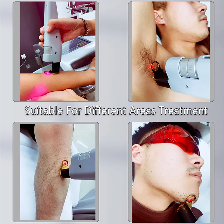 Dispositivo de Remoção de Pelo a Laser Alexandrite ND YAG Alex