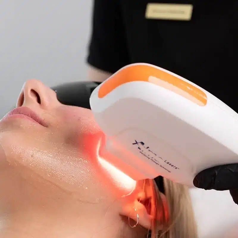 Máquina profissional IPL Dpl para remoção de pelos, rejuvenescimento da pele e pigmentação
