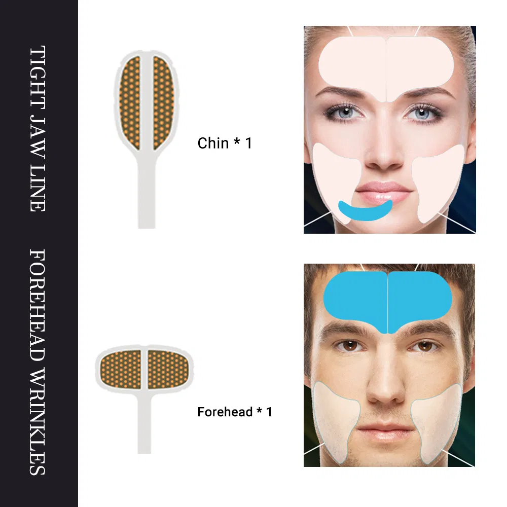 Dispositivo baseado em DPL para remoção de pelos, remoção de acne, rejuvenescimento da pele, remoção de veias emaranhadas