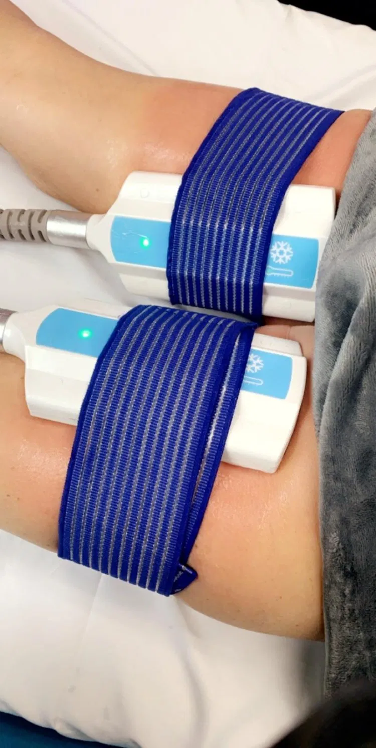 2023 Equipamento de Beleza para Remoção de Celulite por Crioterapia, Ondas de Choque e EMS