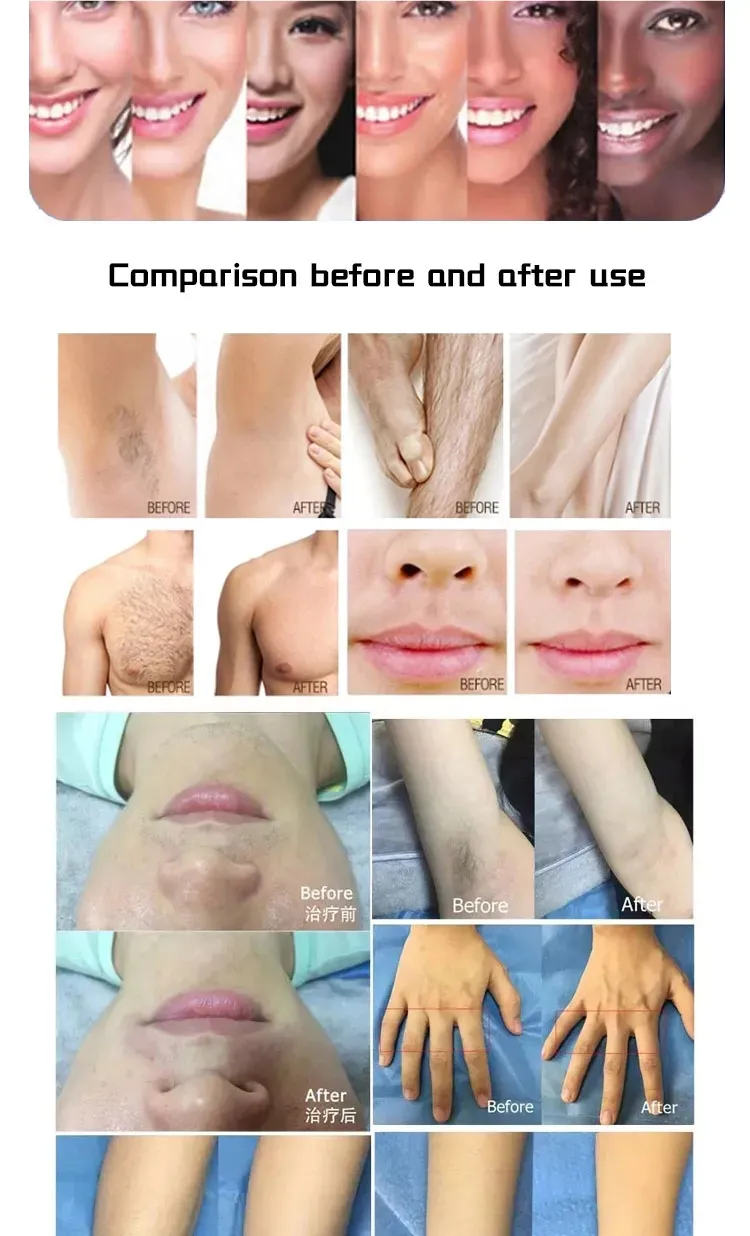 Resultados do tratamento - Antes e Depois