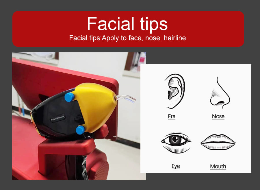 1600W 3 Onda Vertical Permanente 808nm Diodo Laser/ Remoção de Cabelo Indolor /Remoção de Cabelo 808nm Dispositivo de Laser Diodo