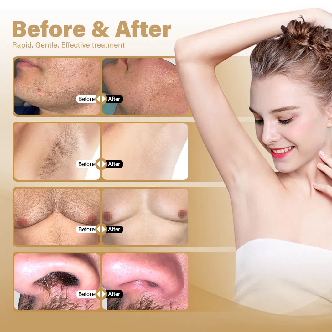 Resultados Antes e Depois do Tratamento a Laser