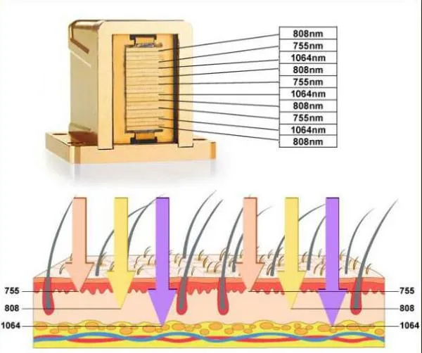 Teoria de Trabalho do Laser de Diodo