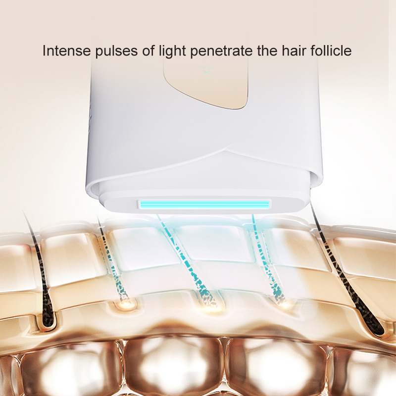Máquina de Beleza Portátil para Depilação Indolor Multifuncional Dispositivo de Remoção de Pelos a Laser IPL