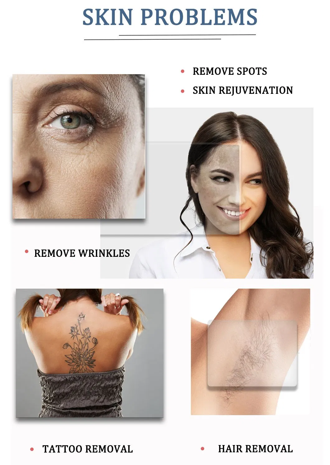 Dispositivo de Remoção de Pelos a Laser IPL Permanente e Indolor, Fotorejuvenescimento para Mulheres, Epilador a Laser