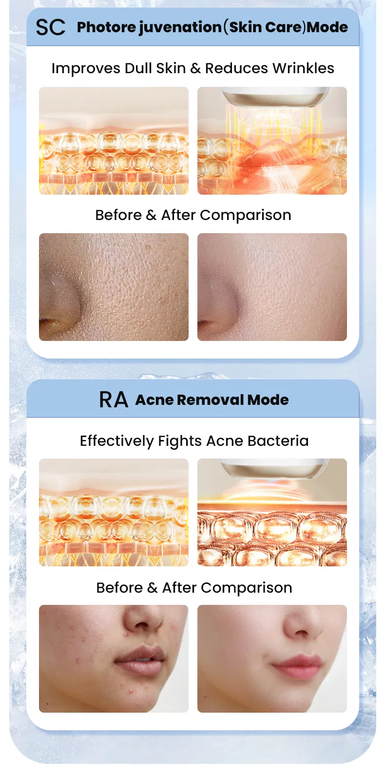 Dispositivo de Remoção de Cabelo Facial e Corporal IPL Frio e Indolor para Uso Doméstico