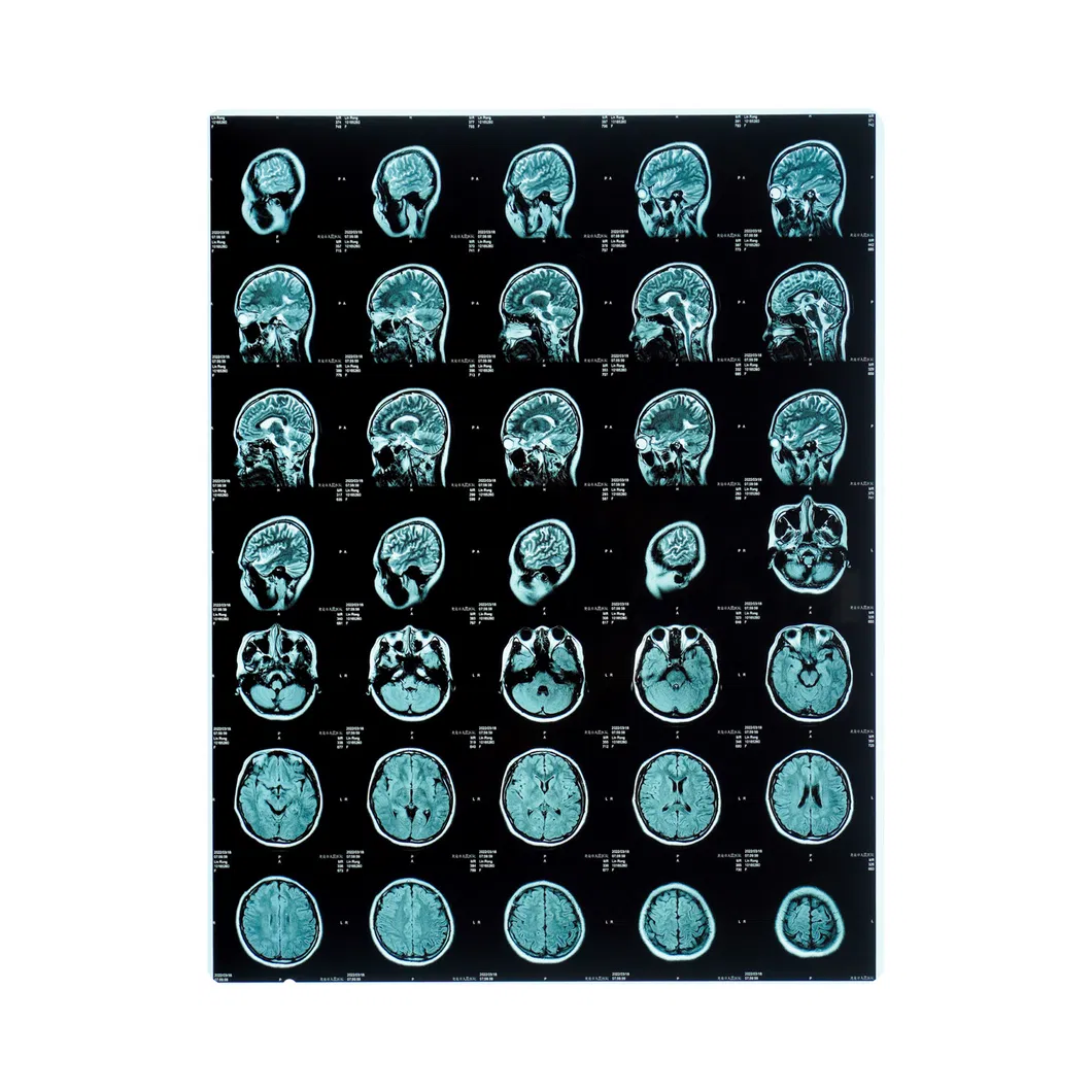 Filme Radiografia