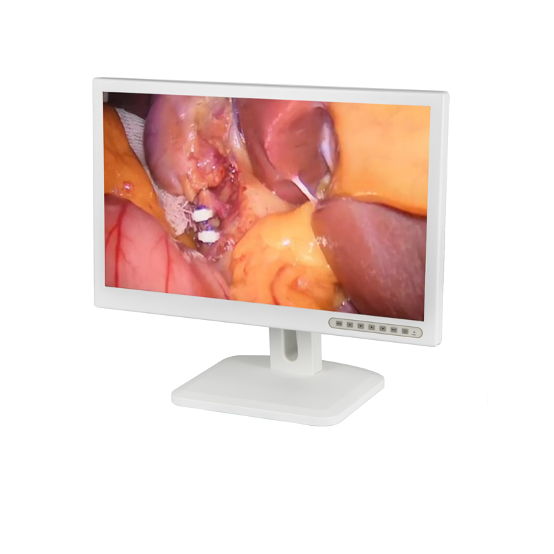 Endoscopy Medical Monitor Endoscope Auto Focus Equipment for Surgery