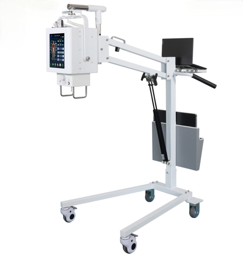 Multifunctional Medical Imaging Digital Radiography 5.6kw Portable Xray Machine Mobile X-ray Equipment